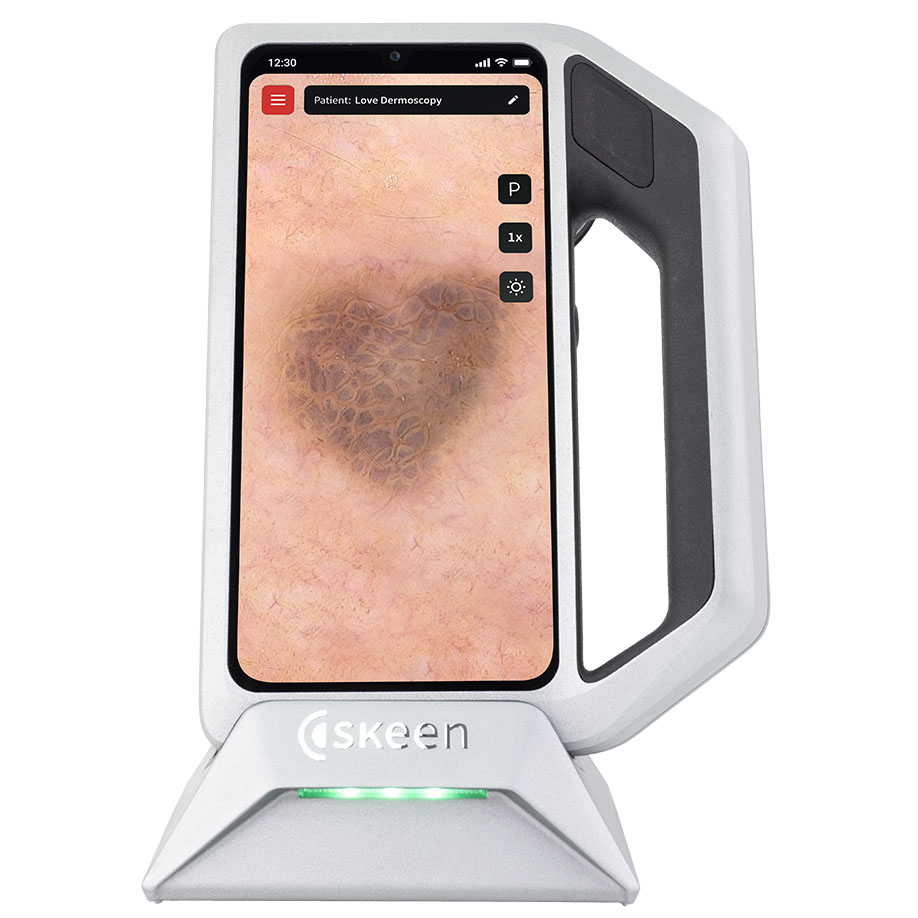 FotoFinder skeen Dermatoskop