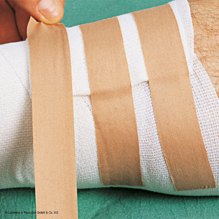 Porofix Heftpflaster hautfarben,