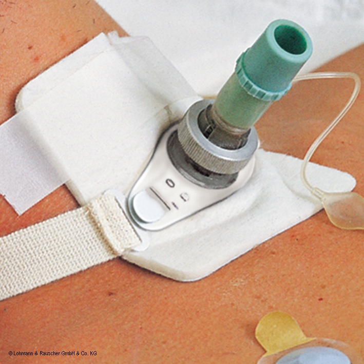 Metalline Tracheo-Kompressen steril,