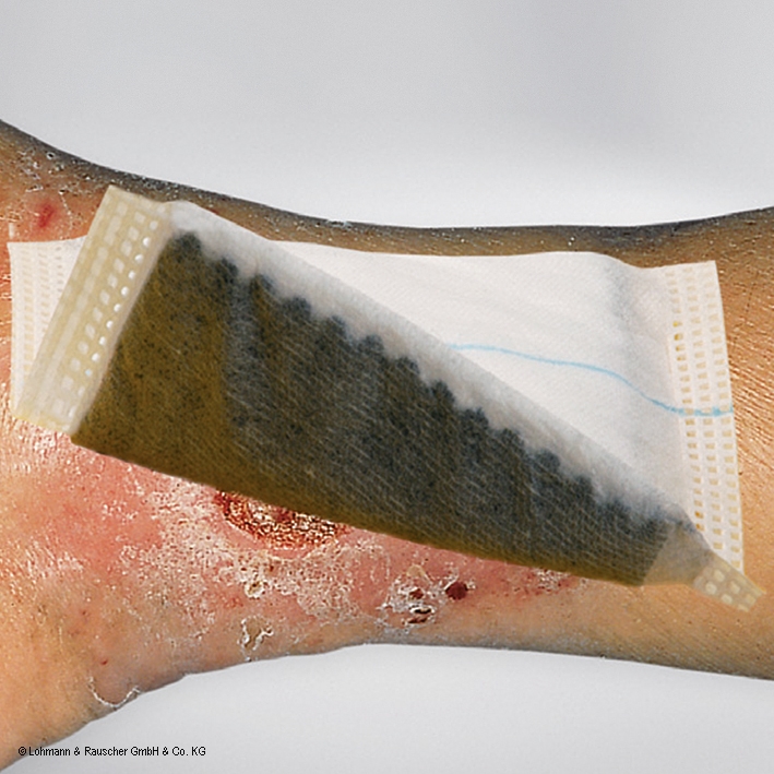 Vliwaktiv Ag Aktivkohle-Saugkompressen