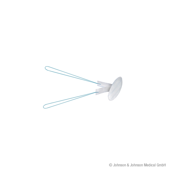 Proceed Ventral Patch Ø 4,3 cm