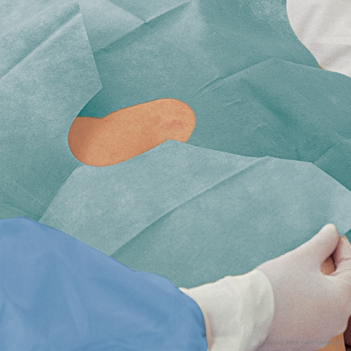 Foliodrape Protect Lochtücher steril