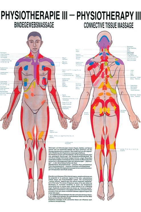 anat. Poster: Physiotherapie Bindegewebsmassage, 50 x 70 cm, Papier